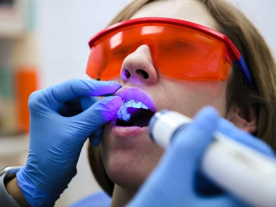 Неприятный запах изо рта: стоматолог рассказал, как легко освежить дыхание