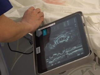 Точнее, чем обычно: новый аппарат помог врачам Егорьевка выбрать правильную тактику лечения сердца