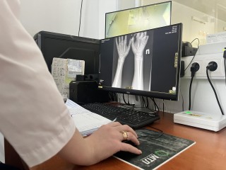 Травпункты перегружены: более 160 человек обратились в травматологию Шатуры за первую неделю года