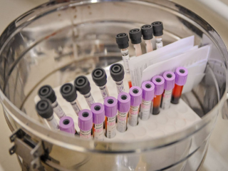 Врач Красногорской больницы рекомендует сделать биохимию крови после праздников