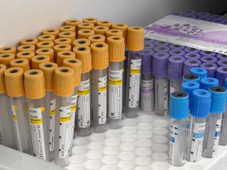 Постоянная усталость не проходит? Врач назвала простой анализ, который может найти скрытую причину