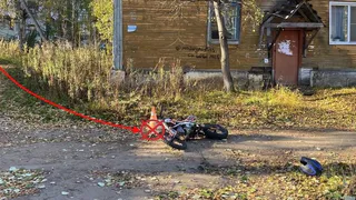 В Коми два подростка на питбайке попали в ДТП