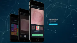 Ученые создали приложение для определения болезни по фото