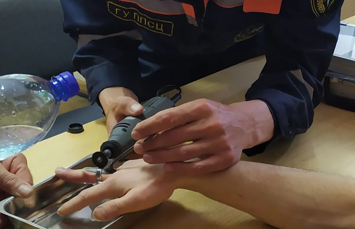 В Пензе спасатели помогли женщине снять кольцо со сломанного пальца