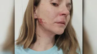 Неизвестный душил девушку на Почтовой. Мы связались с пострадавшей