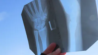 В травмпуткте на Чкалова рентген отключается из-за скачков напряжения