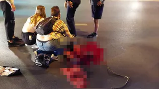 Появились фото с пострадавшим на улице Ленина в Рязани мотоциклистом