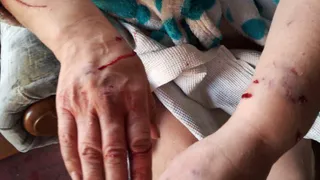 Соцсети: в Полянах свободно разгуливающий алабай напал на женщину