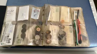 Врачи Челябинской области показали коллекцию вытащенных из детей и взрослых предметов