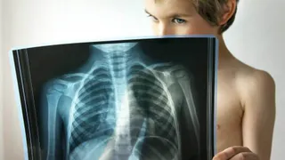 Два Магнитогорских школьника попали в реанимацию из-за пневмонии