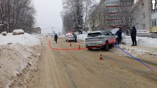 В жестком ДТП школьница из Коми получила вывих челюсти