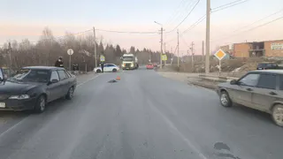 В Коми пешеход оказалась под колесами Daewoo Nexia: женщина в коме