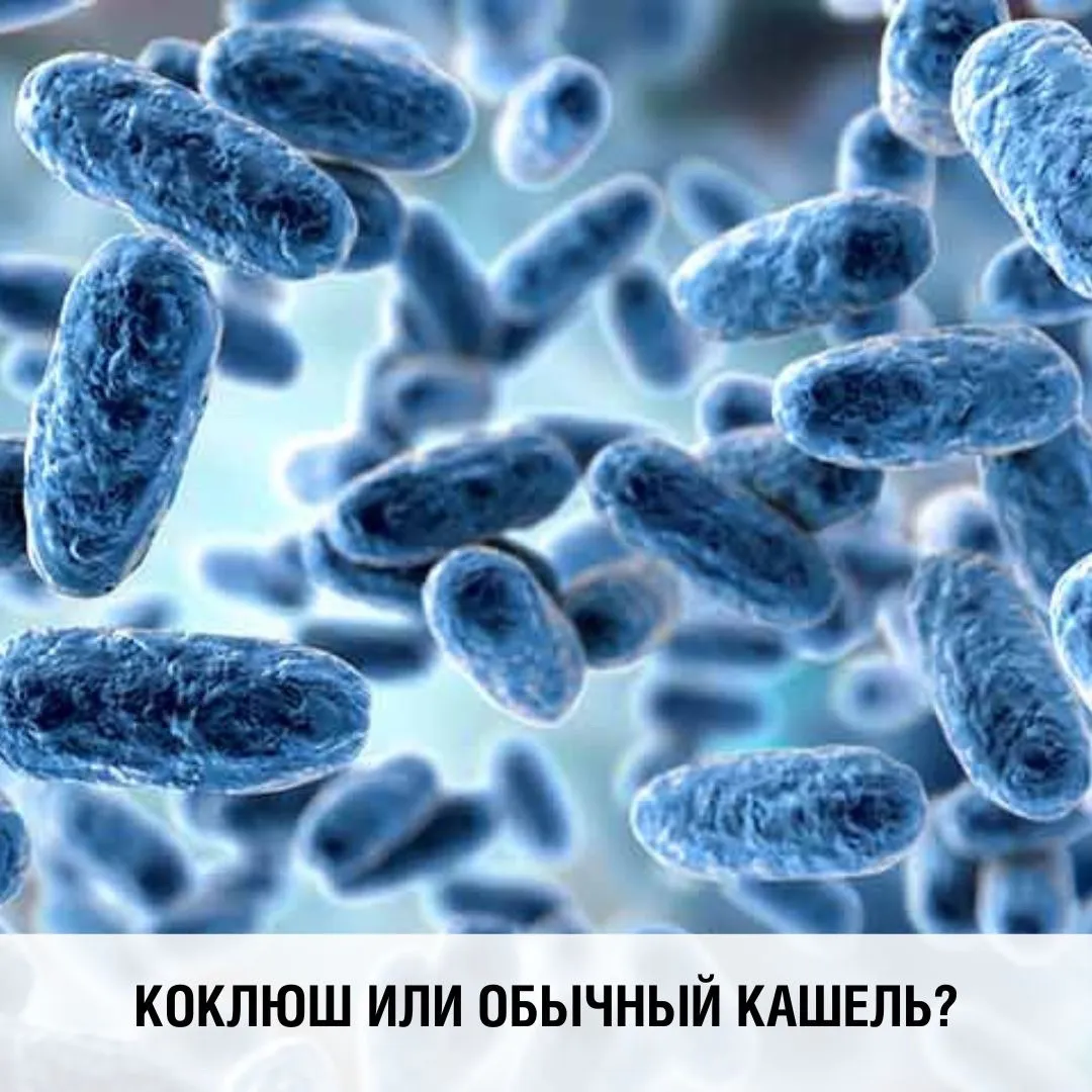 Как отличить обычный кашель от коклюша?