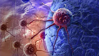 Атакующие рак: названы продукты, которые активно борются с больными клетками в организме