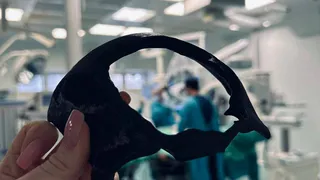 Татарстанские врачи восстановили бойцу СВО лоб с помощью 3D-технологий