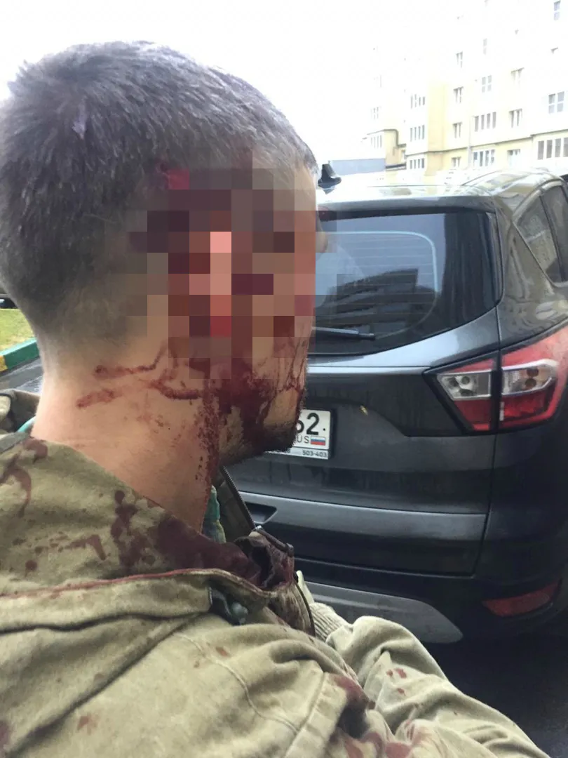 Дикая история: директор управляющей компании ударил молотком владельца квартиры