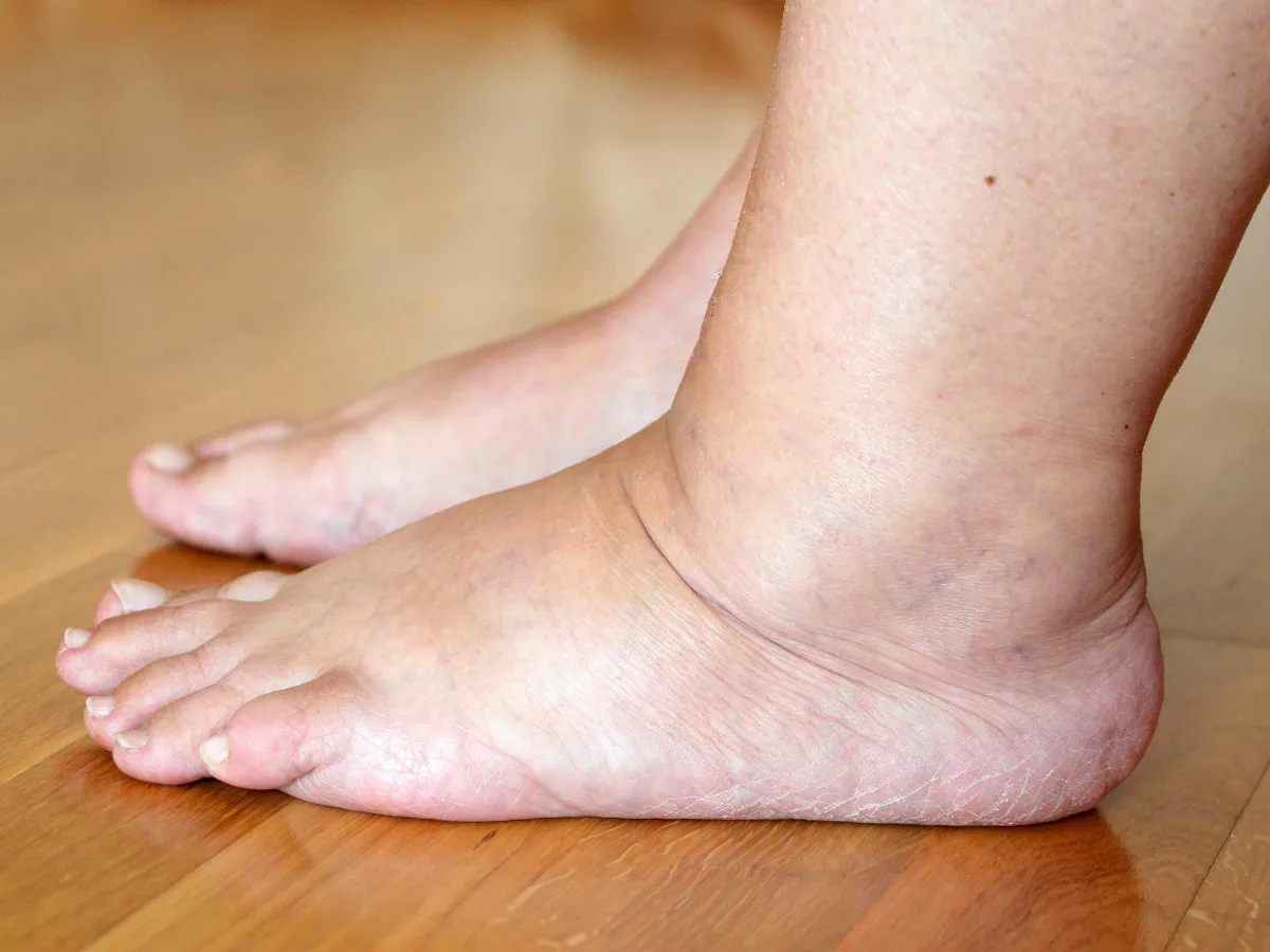 Ноги перестали отекать после работы: перед сном делаю такую ванночку — усталость снимает на 100%