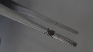 За неделю во Владимирской области от укусов клещей пострадали 39 человек