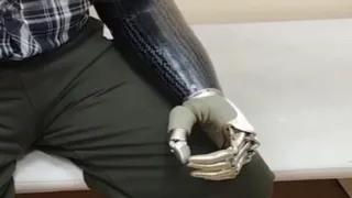 Жителю Владимирской области установили бионическую кисть стоимостью 3,3 миллиона рублей