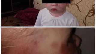 Малыши в больнице: рязанских детей из неблагополучной семьи держали в нечеловеческих условиях