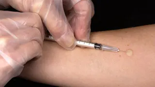 Развеян самый устойчивый миф о пробе Манту