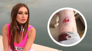 Бродячая собака покусала рязанскую модель Наталью Соболеву