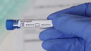 Для новогодних мероприятий в Брянской области закупят 80 тысяч ПЦР-тестов