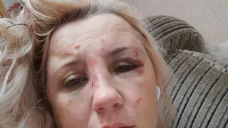 Пинали по голове: маму известного рязанского блоггера зверски избили в центре города