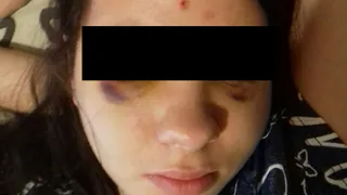 Избиение рязанки тремя неизвестными стали расследовать спустя почти две недели