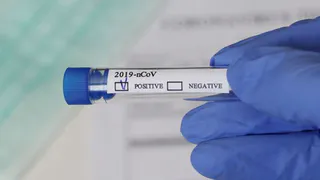 Срок действия ПЦР-теста в Брянской области сократили до 48 часов