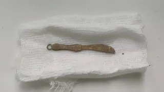 Врачи ОДКБ извлекли из кишечника ребенка игрушечный кинжал