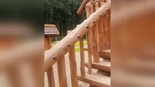 На распоровший руку 10-летнему ребёнку штырь в Рязани поставили заглушку