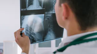 Ребенку с пневмонией в Магнитогорске отказали в рентгене из-за дефицита пленки