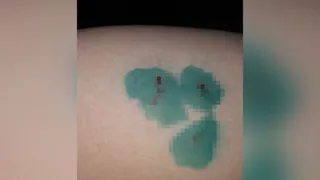 В Рыбном женщину покусала бродячая собака