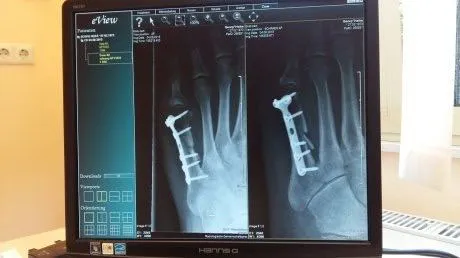 В Пензенской области рентгеновские снимки теперь печатают на бумаге