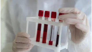 Доктор Мясников раскрыл, за что на самом деле отвечает группа крови и как она влияет на нашу жизнь