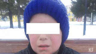 Мальчику, ударившегося головой на горке, помогли нейрохирурги ДРКБ Казани