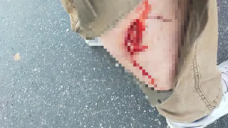 Собака пыталась загрызть рязанца: человек отделался прокушенной ногой