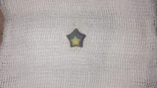 Во Владимире врачи спасли двухлетнего малыша, проглотившего пластиковое украшение