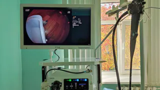 Современное эндоскопическое оборудование появилось в Центральной городской больнице Чебоксар: повышение эффективности диагностики заболеваний ЖКТ