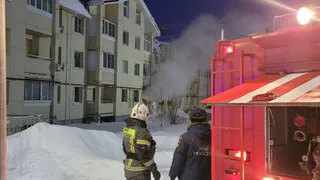 Житель Коми сильно пострадал при пожаре