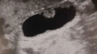 Боли справа под ребрами: с чем они могут быть связаны и как лечить?