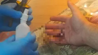 Спортсмен получил травму при занятиях на турнике