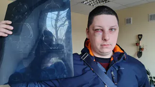 Инженер проломил череп рязанцу после жалоб на капремонт