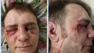 На железнодорожной платформе Ходынино неизвестные избили двоих мужчин