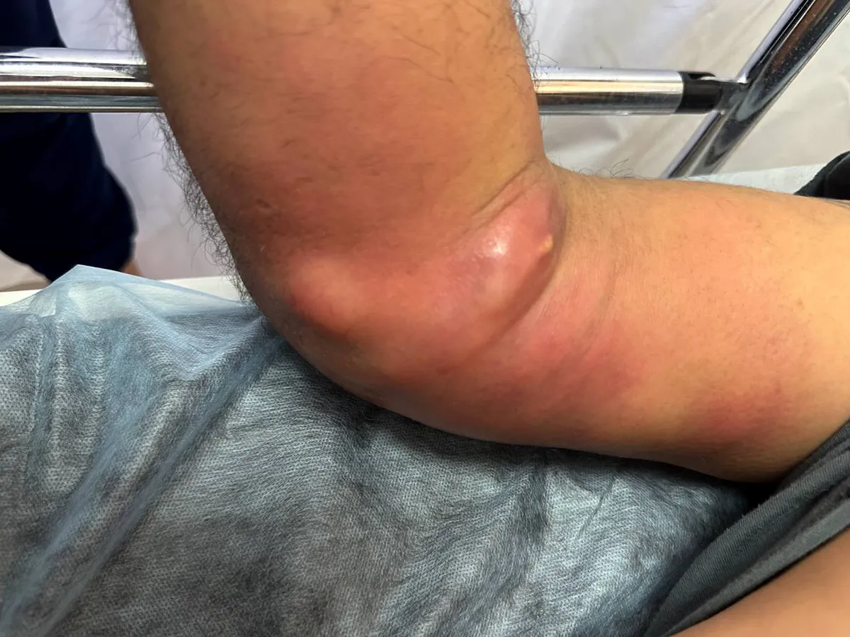 Татарстанские врачи спасли испанца от суицида