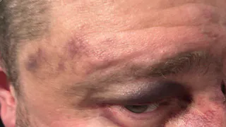 На стадионе «Спартак» в Рязани произошла драка между членами спортивного общества