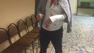 Чудом остался жив: в Рязани зверски избили журналиста Михаила Комарова