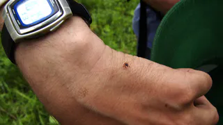 С начала апреля 15 человек пострадали от укусов клещей