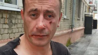 В Клинцах проводится проверка по факту избиения пенсионерки